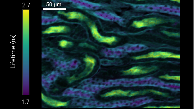 Photon lifetime imaging of mouse kidney sample