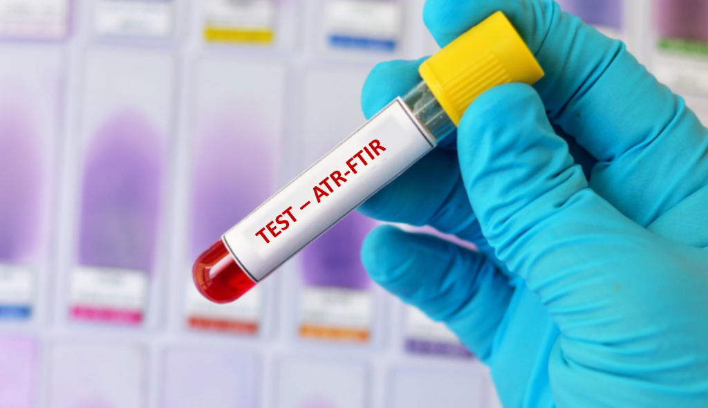 Atr Ftir Blood Serum Analysis Blood Spectroscopy Hot Sex Picture